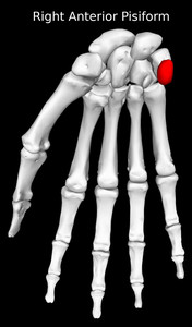 Pisiform Bone